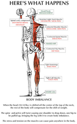 Figure 7: The Effects of the Atlas Subluxation