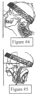 Figures #4 and #5