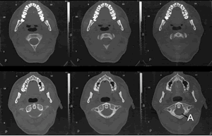 2 Dimensional CT Scan