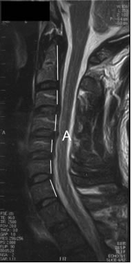 Magnetic Resonance Imaging (MRI)